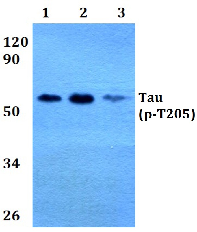 Tau (phospho~T205)