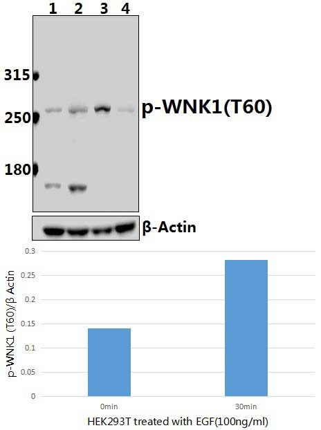 WNK1 (phospho~T60)