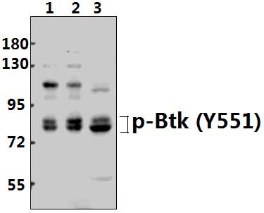 BTK (phospho~Y551)