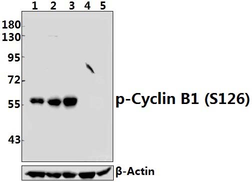 Cyclin B1 (phospho~S126)