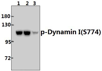 Dynamin~1 (phospho~S774)