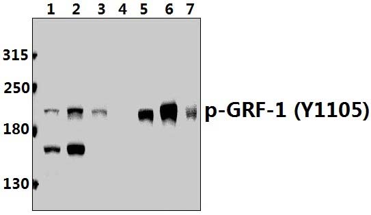 GRF~1 (phospho~Y1105)