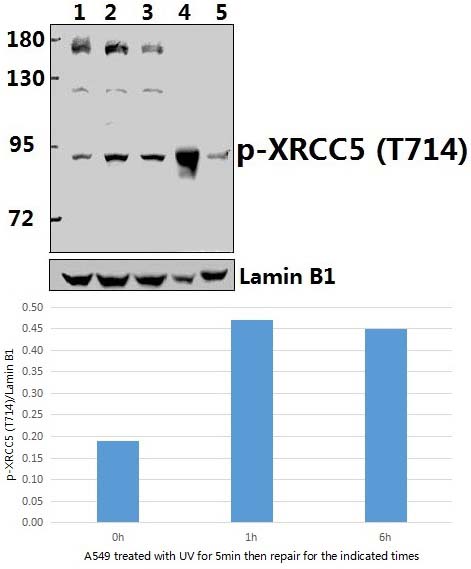 XRCC5 (phospho~T714)
