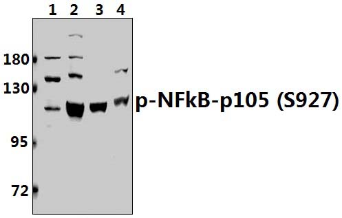 NFkB~p105 (phospho~S927)