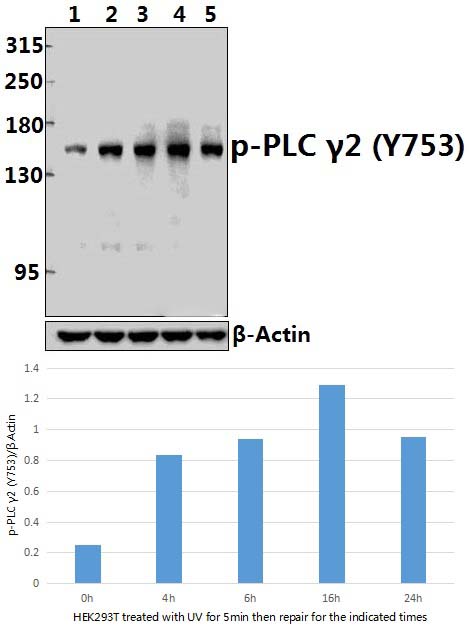 PLC γ2 (phospho~Y753)