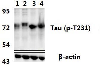 Tau (phospho~T231)