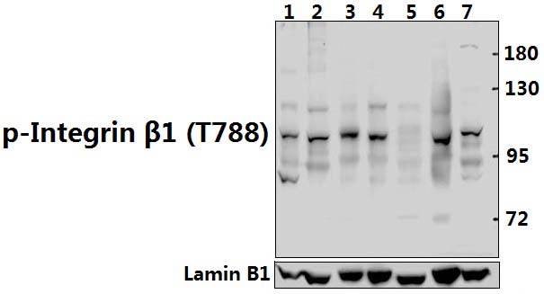 Integrin β1 (phospho~T788)