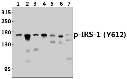 IRS~1 (phospho~Y612)