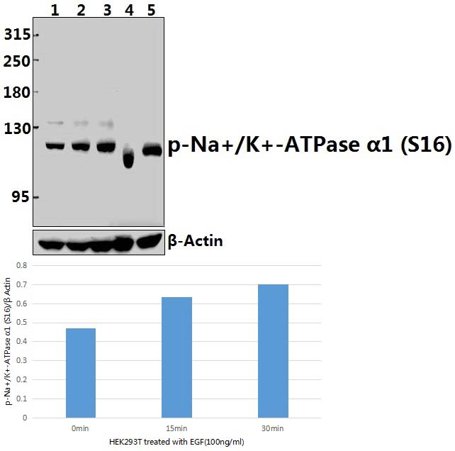 Na+/K+~ATPase α1 (phospho~S16)