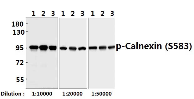 Calnexin (phospho~S583)