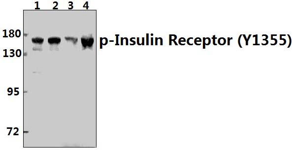 Insulin Receptor (phospho~Y1355)