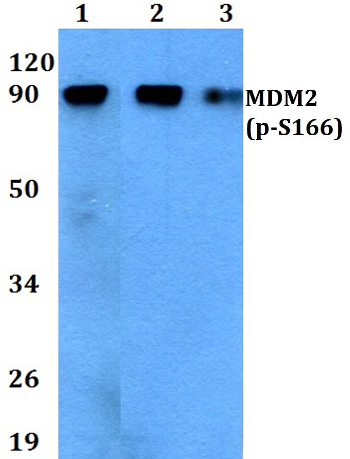 MDM2 (phospho~S166)