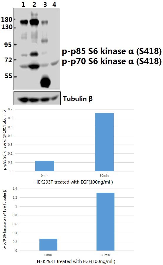 p70 S6K (phospho~S418)