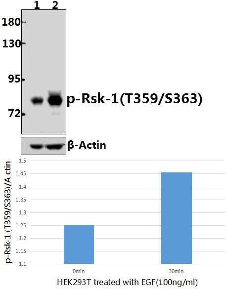 Rsk~1 (phospho~T359/S363)