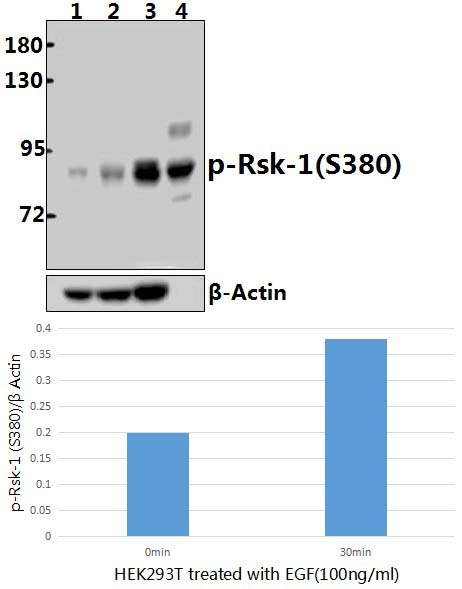 Rsk~1 (phospho~S380)