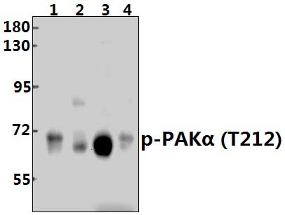 PAKα (phospho~T212)