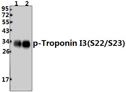 Troponin I3 (phospho~S22/S23)