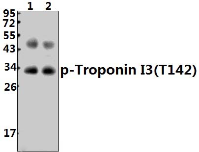 Troponin I3 (phospho~T142)