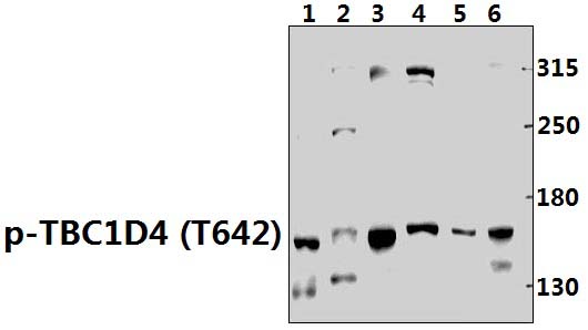 TBC1D4 (phospho~T642)