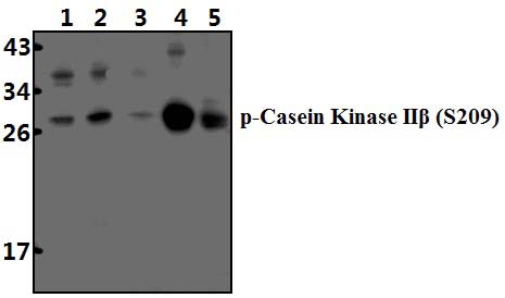 Casein Kinase IIβ (phospho~S209)