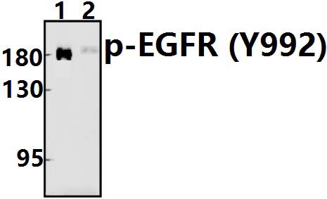 EGFR (phospho~Y992)