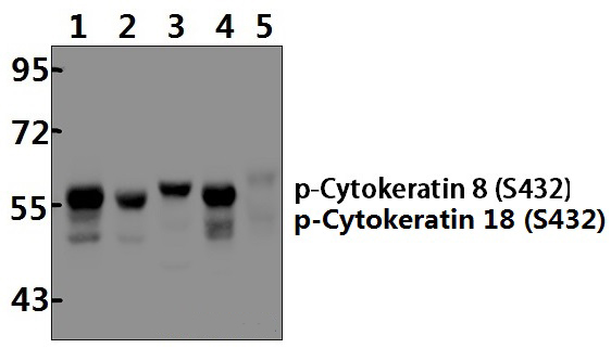 Cytokeratin 8 (phospho~S432)