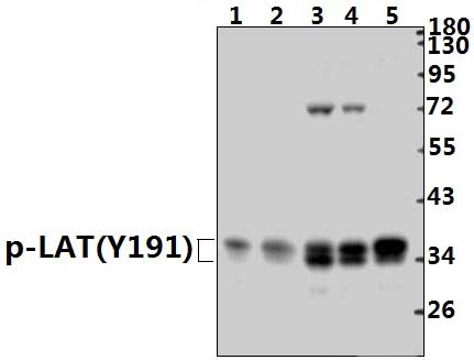 LAT (phospho~Y191)
