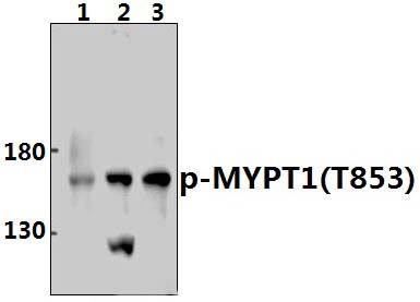 MYPT1 (phospho~T853)