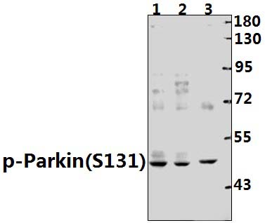 Parkin (phospho~S131)