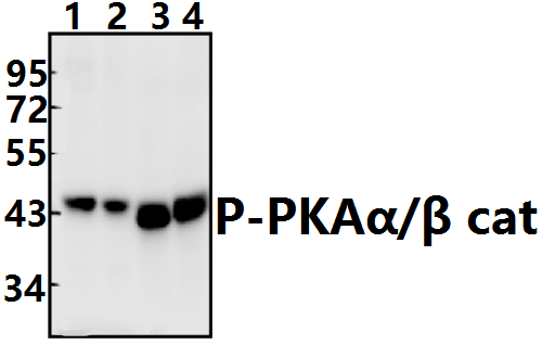 PKAα/β cat (phospho~T197)