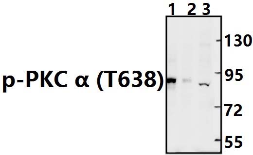 PKC α (phospho~T638)