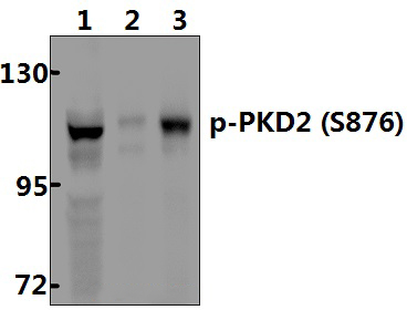 PKD2 (phospho~S876)