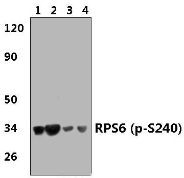 RPS6 (phospho~S240)