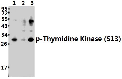TK (phospho~S13)