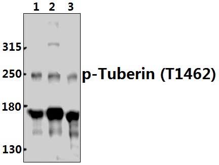 Tuberin (phospho~T1462)