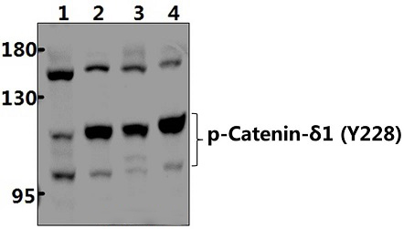 Catenin~δ1 (phospho~Y228)