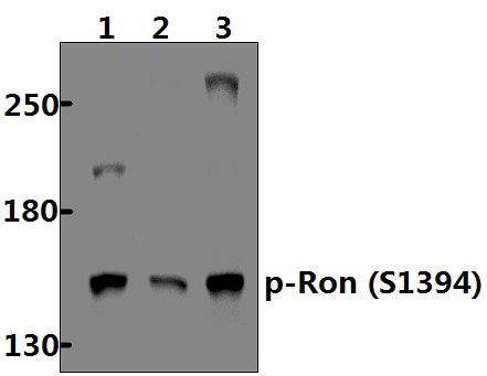 Ron (phospho~S1394)