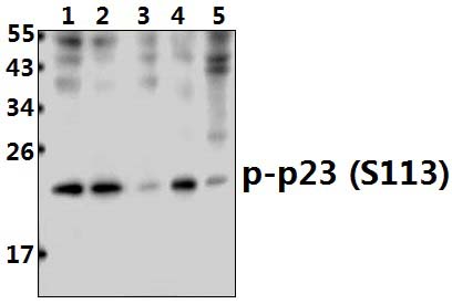 TEBP (phospho~S133)