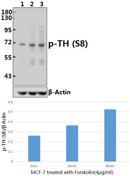 TH (phospho~S8)