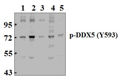 p68 RNA Helicase (phospho~Y593)