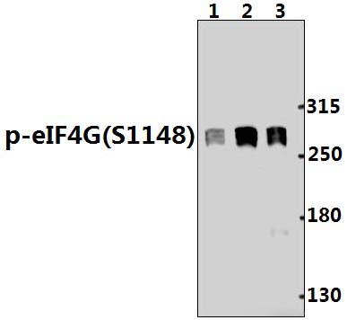 EIF4G1 (phospho~S1148)