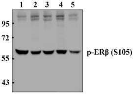 ERβ (phospho~S105)