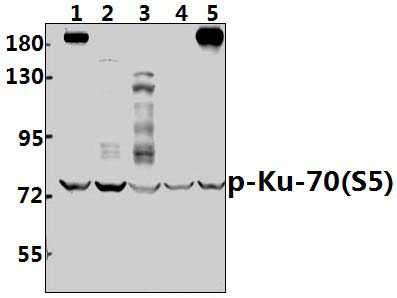 Ku~70 (phospho~S5)