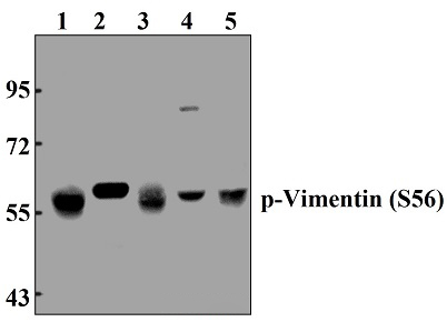Vimentin (phospho~S56)