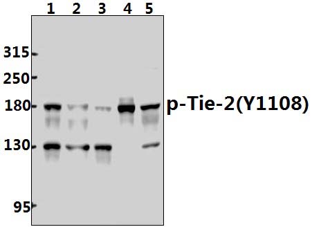 Tie~2 (phospho~Y1108)