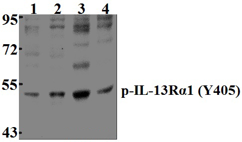 IL~13Rα1 (phospho~Y405)
