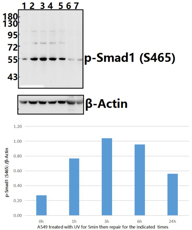 Smad1 (phospho~S465)