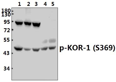 KOR~1 (phospho~S369)