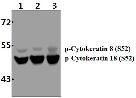 Cytokeratin 18 (phospho~S52)