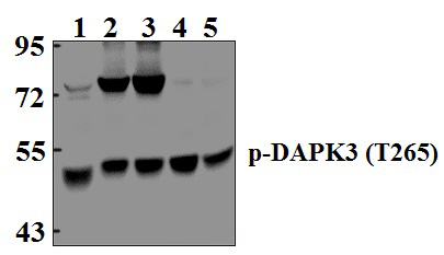 DAPK3 (phospho~T265)